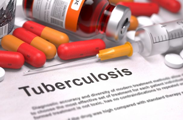 Join fight against tuberculosis, USAID urges Lagosians
